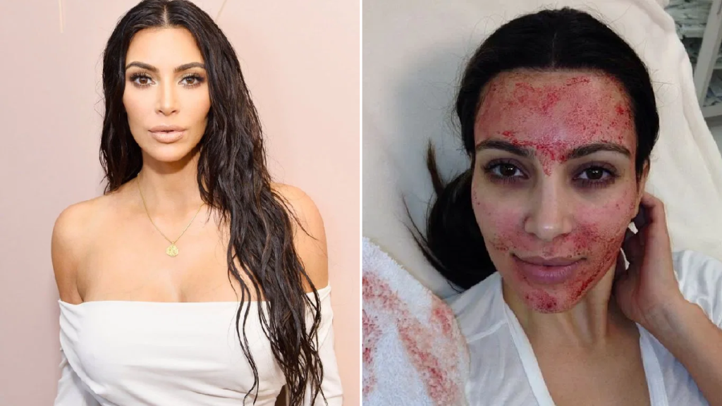 KEEPING UP WITH THE COINS: Kim Kardashian West Sues “Vampire Facial” Doctor For Using Her Name & Likeness