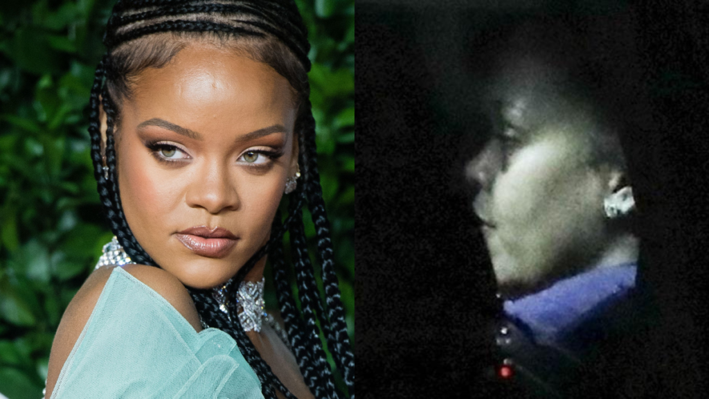 MAN DOWN: Rihanna’s Battered Face Was The Result Of A Nasty E-Scooter Accident