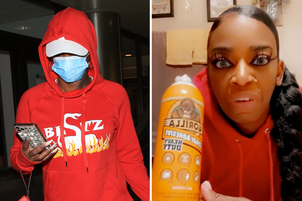 FREE AT LAST! FREE AT LAST!: Gorilla Glue Girl Finally Has Surgery to Remove Glue from Her Scrap; Surprisingly Still Has Hair (WATCH)