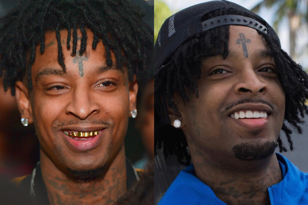 GOT A BAG & FIXED MY TEETH: 21 Savage Claps Back At Haters Attempting to Clown His New Veneers – “I Paid 75k I’ll Be Damned if I Let Y’all Say These Teeth Ain’t Mine”