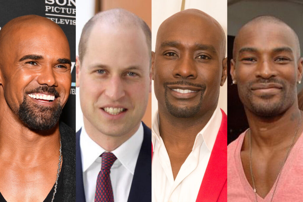 WHO SAID THAT?: A Google Study Names Prince William as the ‘World’s Sexiest Bald Man”… & We the People Are Confused