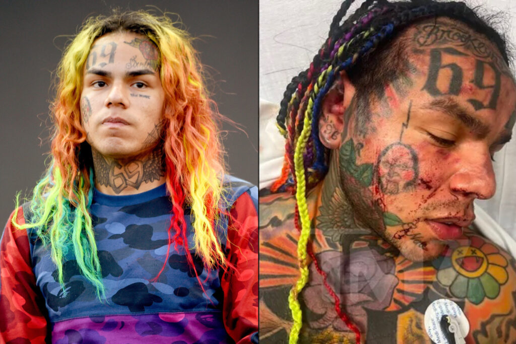 CAUGHT LACKIN’: Tekashi 6ix9ine Rushed to Hospital After Being Jumped in Florida Gym